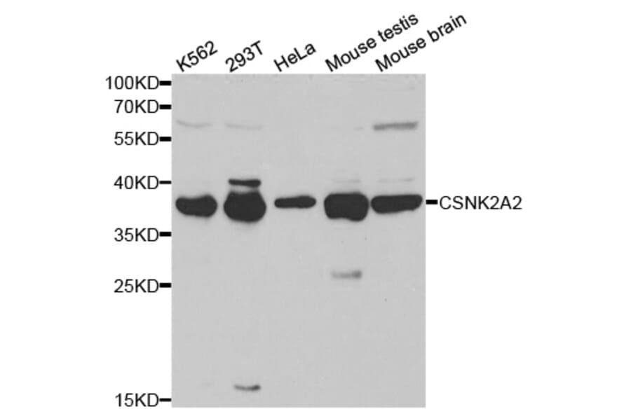 Western blot - CSNK2A2 Antibody from Signalway Antibody (32343) - Antibodies.com