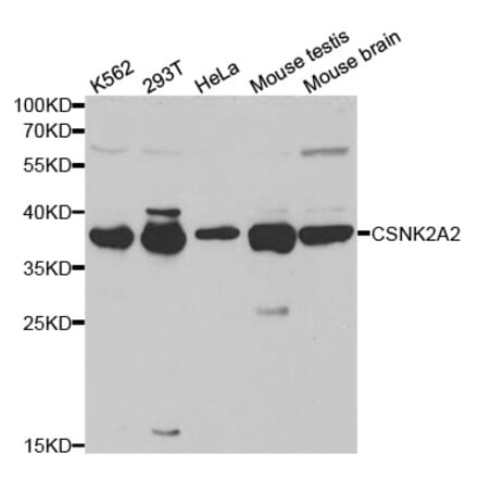 Western blot - CSNK2A2 Antibody from Signalway Antibody (32343) - Antibodies.com