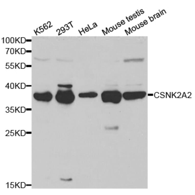 Western blot - CSNK2A2 Antibody from Signalway Antibody (32343) - Antibodies.com