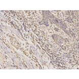 Immunohistochemistry - CSNK2A2 Antibody from Signalway Antibody (32343) - Antibodies.com