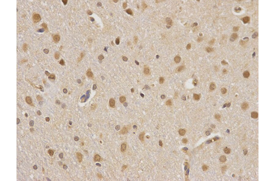 Immunohistochemistry - CSNK2A2 Antibody from Signalway Antibody (32343) - Antibodies.com