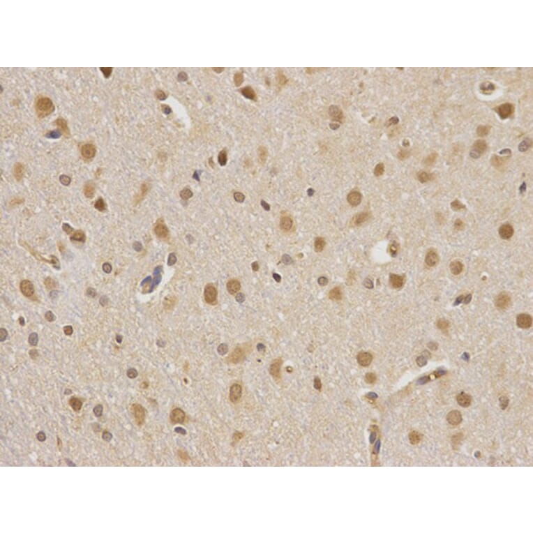 Immunohistochemistry - CSNK2A2 Antibody from Signalway Antibody (32343) - Antibodies.com