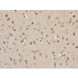 Immunohistochemistry - CSNK2A2 Antibody from Signalway Antibody (32343) - Antibodies.com