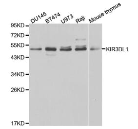 Western blot - KIR3DL1 Antibody from Signalway Antibody (32344) - Antibodies.com
