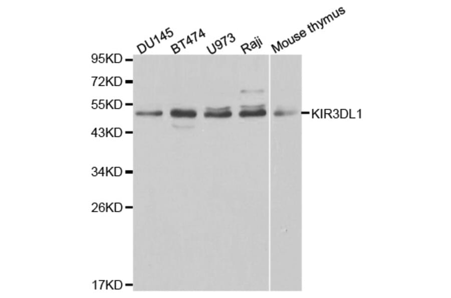 Western blot - KIR3DL1 Antibody from Signalway Antibody (32344) - Antibodies.com