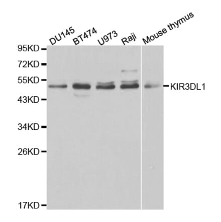 Western blot - KIR3DL1 Antibody from Signalway Antibody (32344) - Antibodies.com