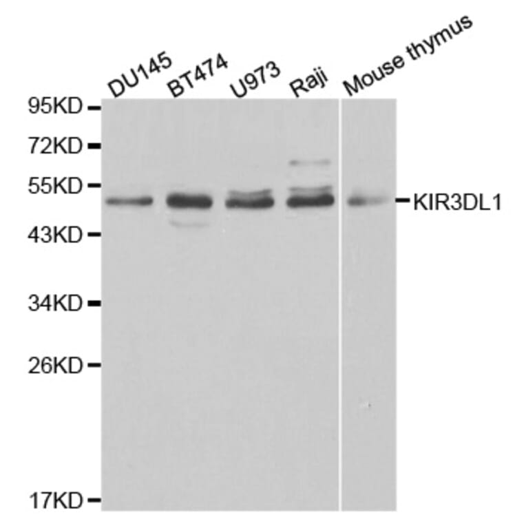 Western blot - KIR3DL1 Antibody from Signalway Antibody (32344) - Antibodies.com