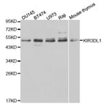 Western blot - KIR3DL1 Antibody from Signalway Antibody (32344) - Antibodies.com