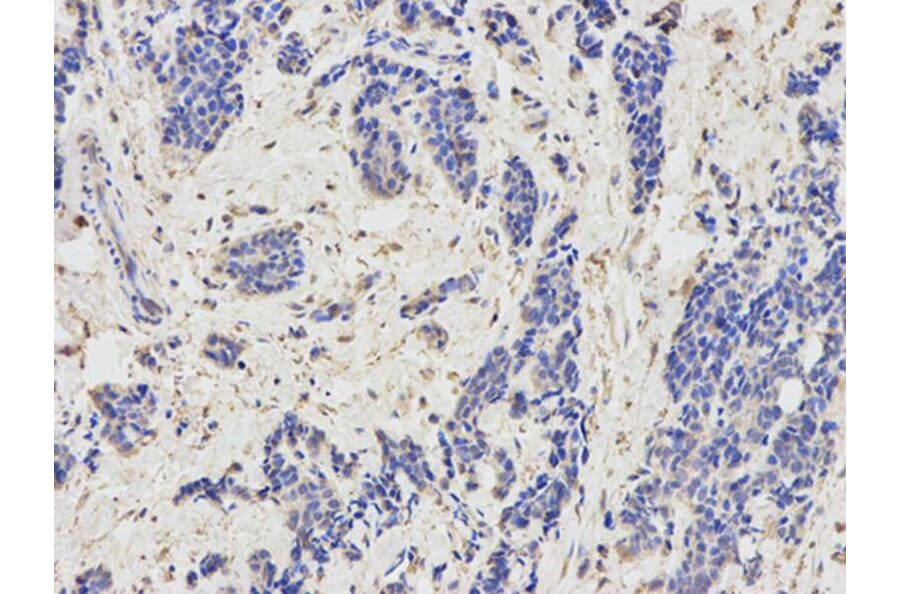 Immunohistochemistry - KIR3DL1 Antibody from Signalway Antibody (32344) - Antibodies.com