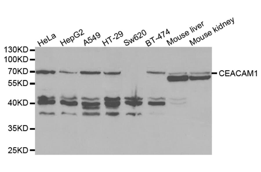 Western blot - CEACAM1 Antibody from Signalway Antibody (32394) - Antibodies.com