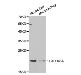 Western blot - GADD45A Antibody from Signalway Antibody (32438) - Antibodies.com