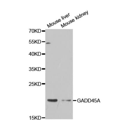 Western blot - GADD45A Antibody from Signalway Antibody (32438) - Antibodies.com