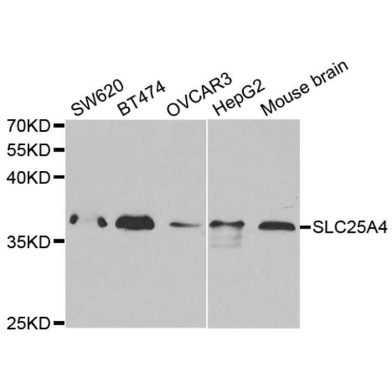 Western blot - SLC25A4 Antibody from Signalway Antibody (32484) - Antibodies.com