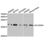 Western blot - SLC25A4 Antibody from Signalway Antibody (32484) - Antibodies.com