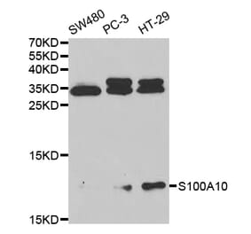 Western blot - S100A10 Antibody from Signalway Antibody (32538) - Antibodies.com