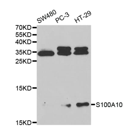 Western blot - S100A10 Antibody from Signalway Antibody (32538) - Antibodies.com