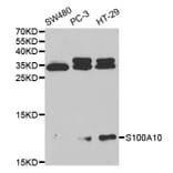 Western blot - S100A10 Antibody from Signalway Antibody (32538) - Antibodies.com