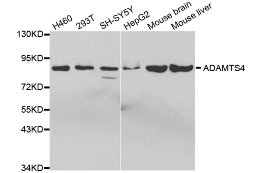 Western blot - ADAMTS4 Antibody from Signalway Antibody (32691) - Antibodies.com