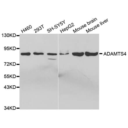 Western blot - ADAMTS4 Antibody from Signalway Antibody (32691) - Antibodies.com