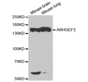 Western blot - ARHGEF2 Antibody from Signalway Antibody (32701) - Antibodies.com