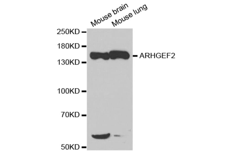 Western blot - ARHGEF2 Antibody from Signalway Antibody (32701) - Antibodies.com