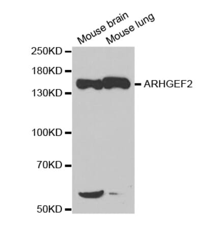 Western blot - ARHGEF2 Antibody from Signalway Antibody (32701) - Antibodies.com