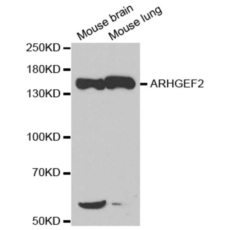 Western blot - ARHGEF2 Antibody from Signalway Antibody (32701) - Antibodies.com