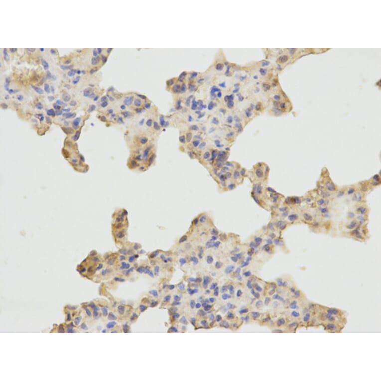 Immunohistochemistry - ARHGEF2 Antibody from Signalway Antibody (32701) - Antibodies.com