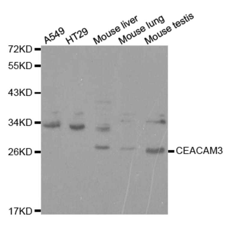 Western blot - CEACAM3 Antibody from Signalway Antibody (32737) - Antibodies.com