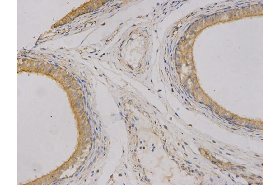 Immunohistochemistry - CEACAM3 Antibody from Signalway Antibody (32737) - Antibodies.com