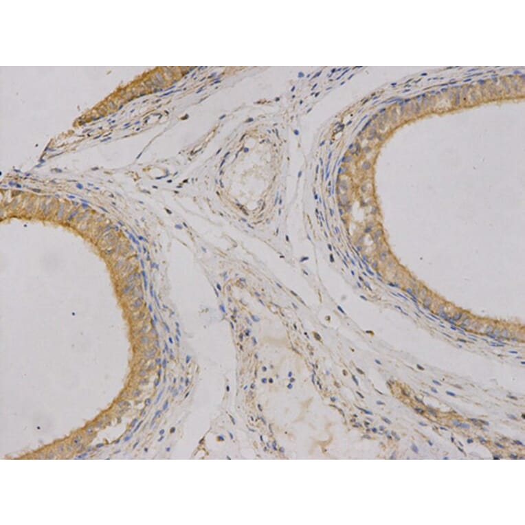 Immunohistochemistry - CEACAM3 Antibody from Signalway Antibody (32737) - Antibodies.com