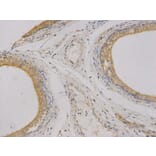 Immunohistochemistry - CEACAM3 Antibody from Signalway Antibody (32737) - Antibodies.com