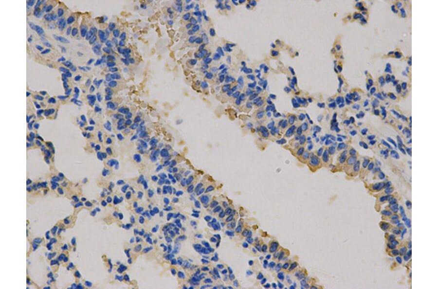 Immunohistochemistry - CEACAM3 Antibody from Signalway Antibody (32737) - Antibodies.com