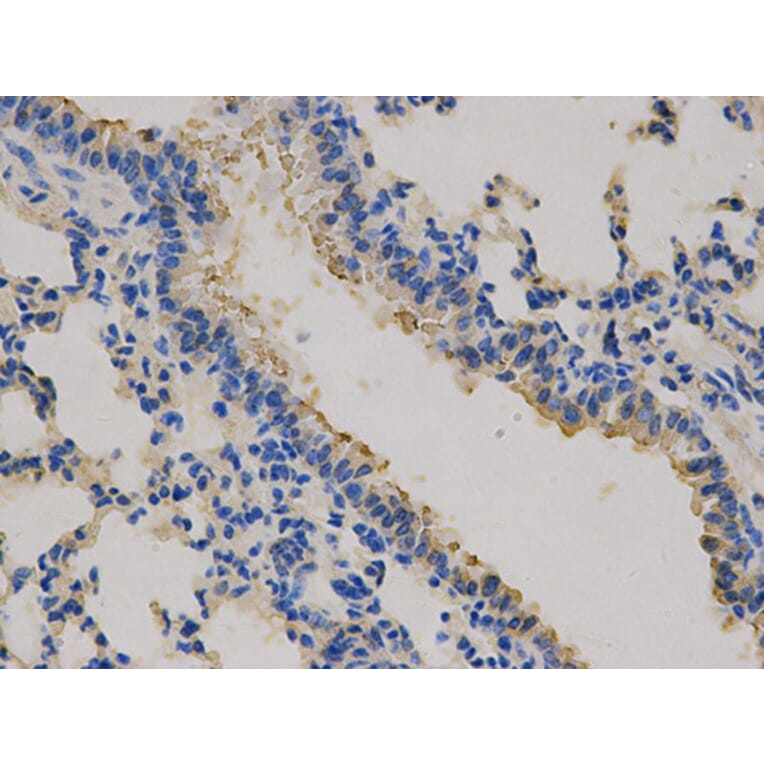 Immunohistochemistry - CEACAM3 Antibody from Signalway Antibody (32737) - Antibodies.com