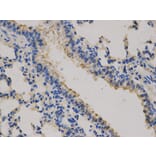 Immunohistochemistry - CEACAM3 Antibody from Signalway Antibody (32737) - Antibodies.com
