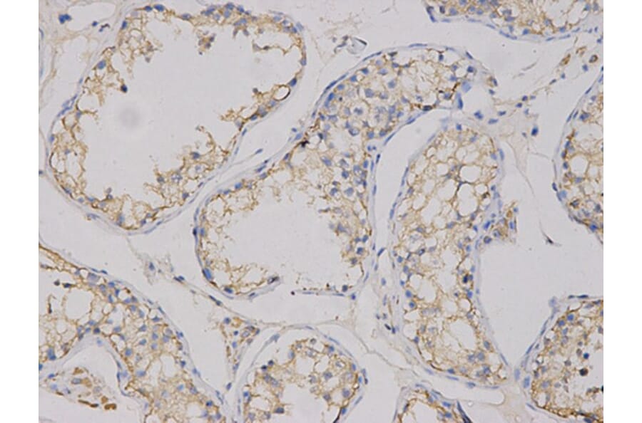 Immunohistochemistry - CEACAM3 Antibody from Signalway Antibody (32737) - Antibodies.com