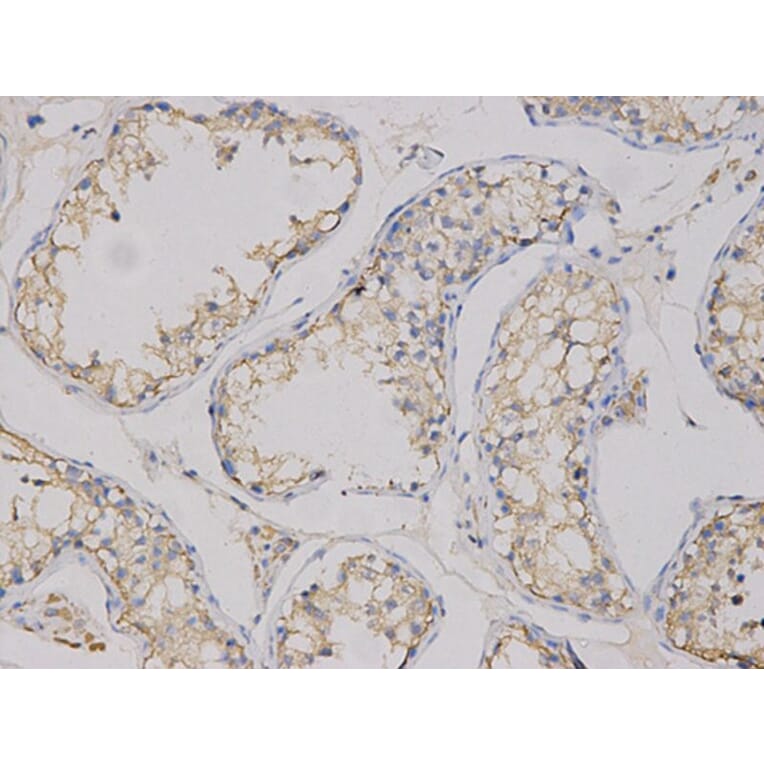 Immunohistochemistry - CEACAM3 Antibody from Signalway Antibody (32737) - Antibodies.com
