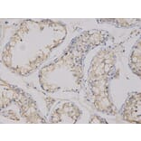 Immunohistochemistry - CEACAM3 Antibody from Signalway Antibody (32737) - Antibodies.com