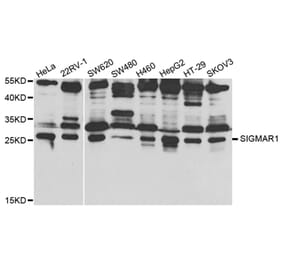 Western blot - SIGMAR1 Antibody from Signalway Antibody (32876) - Antibodies.com