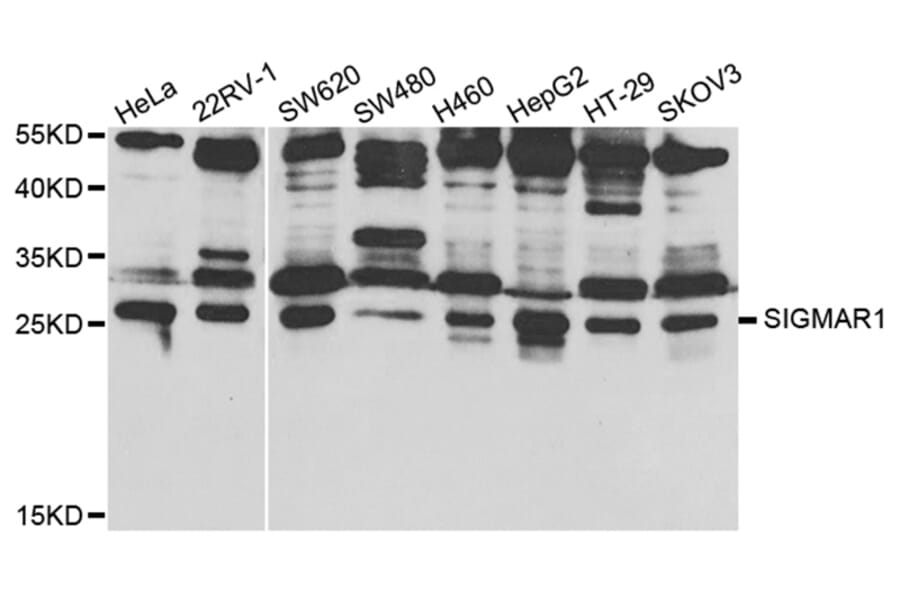 Western blot - SIGMAR1 Antibody from Signalway Antibody (32876) - Antibodies.com