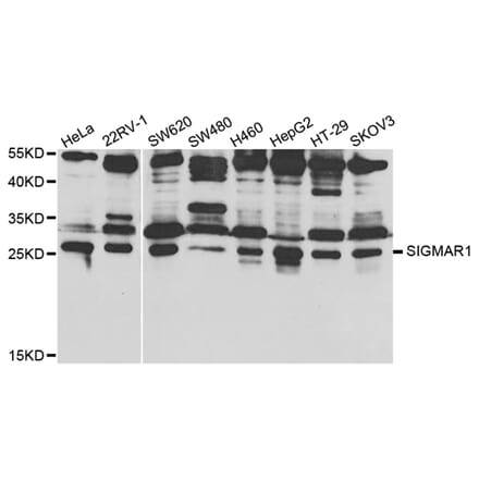 Western blot - SIGMAR1 Antibody from Signalway Antibody (32876) - Antibodies.com