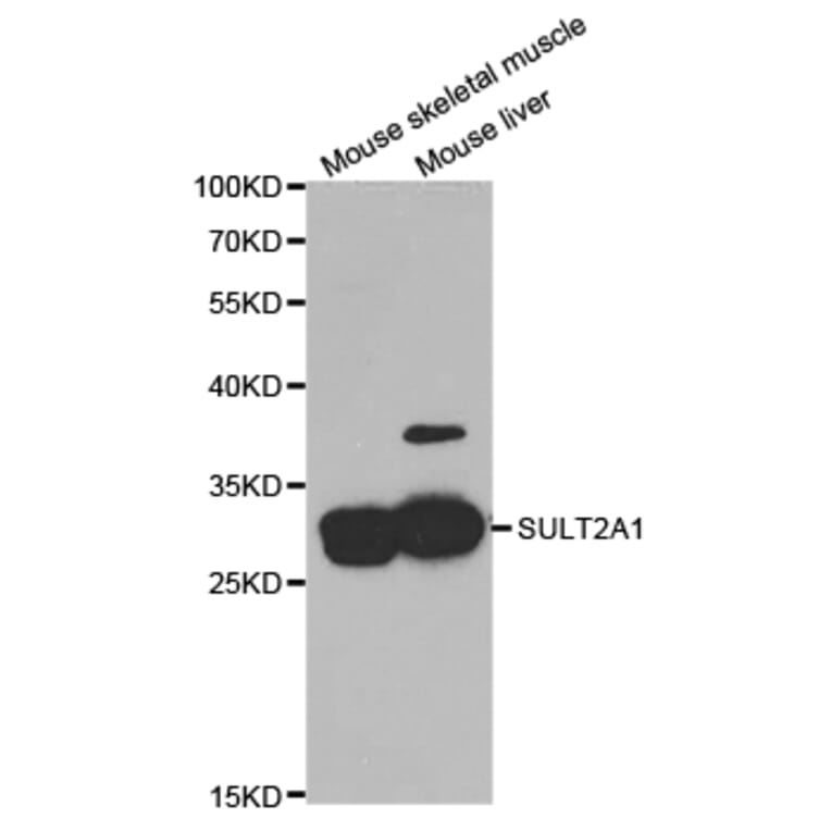 Western blot - SULT2A1 Antibody from Signalway Antibody (32884) - Antibodies.com