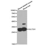 Western blot - SULT2A1 Antibody from Signalway Antibody (32884) - Antibodies.com