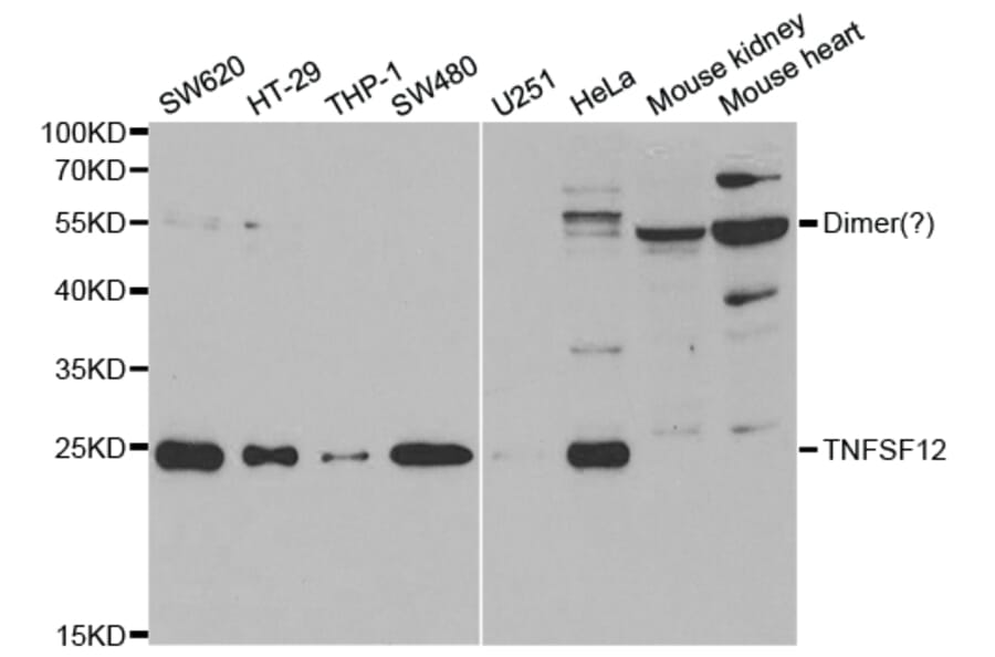 Western blot - TNFSF12 Antibody from Signalway Antibody (32955) - Antibodies.com