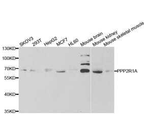Western blot - PPP2R1A Antibody from Signalway Antibody (33051) - Antibodies.com
