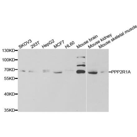 Western blot - PPP2R1A Antibody from Signalway Antibody (33051) - Antibodies.com