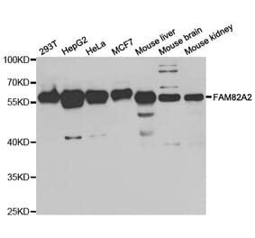 Western blot - FAM82A2 Antibody from Signalway Antibody (33066) - Antibodies.com