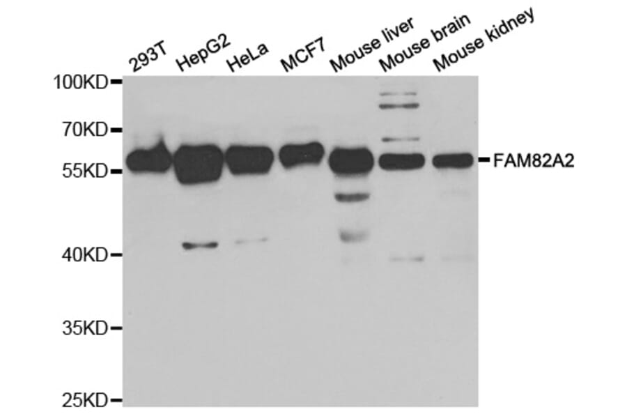 Western blot - FAM82A2 Antibody from Signalway Antibody (33066) - Antibodies.com