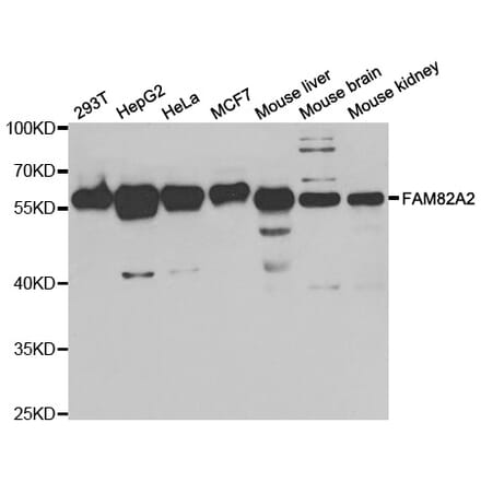 Western blot - FAM82A2 Antibody from Signalway Antibody (33066) - Antibodies.com