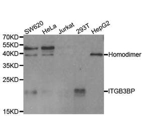 Western blot - ITGB3BP Antibody from Signalway Antibody (33078) - Antibodies.com
